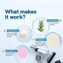 Be Bodywise Rosemary Hair Growth Serum Roll On 25 Ml – 3% Rosemary, 3% Redensyl & 2% Anagain | DHT-Blocking Scalp Serum Boosts Oxygen Flow, Reduces Hair Fall | Paraben/Sulfate-Free | Women & Men - Màu xanh lam - Xem 2