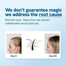 Be Bodywise Rosemary Hair Growth Serum Roll On 25 Ml – 3% Rosemary, 3% Redensyl & 2% Anagain | DHT-Blocking Scalp Serum Boosts Oxygen Flow, Reduces Hair Fall | Paraben/Sulfate-Free | Women & Men - Màu xanh lam - Xem 5