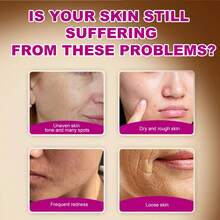 3支装熊果苷7%+氨甲环酸4%乳膏，含70,000ppm熊果苷、40,000ppm氨甲环酸、烟酰胺、谷胱甘肽，可淡化黑斑、雀斑、瑕疵和色素沉着，50毫升 - 透明*3 - 查看 3