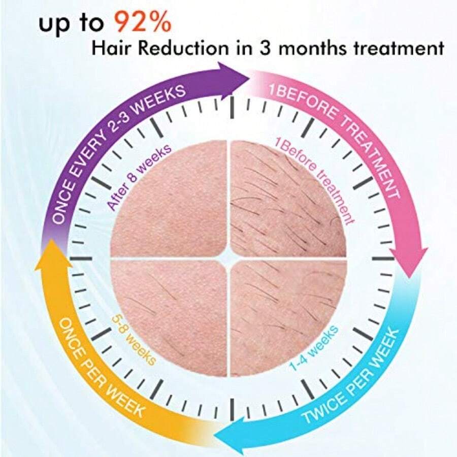 Máquina de Depilación Láser IPL para Mujeres y Hombres 500000 Flashes con Función de Enfriamiento para Depilación Permanente de Cuerpo Completo - Blanco - Ver 1