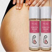 2 Bottles MELAO Firming Body Oil, Specially Designed For Stretch Marks, Stretch Mark Care Oil And Abdominal Care Oil, Suitable For Pregnancy And Postpartum, Containing Natural Plant Oils, Fading Stretch Marks, Firming Skin, 125ml - Rose Red - View 6