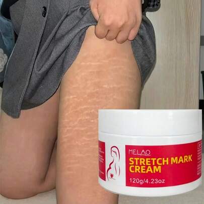  MELAO 妊娠纹霜，120克，专为孕妇及产后女性配制，适用于腹部、臀部和大腿，有效淡化妊娠纹，紧致保湿，蕴含天然植物油，120克/4.23盎司