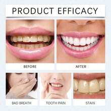 Oralhoe Toothpaste Tablets Improve Bad Breath Remove Smoke Stains Fresh Oral Hygiene Solid Toothpaste Tablet Oral Cleaning And Care Toothpaste Tablets Provide Tooth With Mild Ingredients - Default - 查看 10