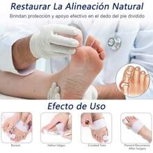 G 2 Piezas Separadores de Dedos de los Pies Cor de uanetes para Muer Cores de Dedos  Pie Bunion Cor Toe tectores FéRula Para uanetes Dia Nocturno para Dedos Superpuestos Blanco - blanco - Ver 4