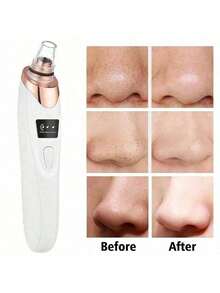 AXH 电动黑头去除器毛孔吸尘器痤疮清洁器 - 白色 - 查看 3