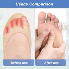 30 Pcs tectores de Dedos de los Pies Tapas de Silicona Suave para los Dedos de los Pies tector de Gel para Dedos de Pie tector Dedos Pie Alia Dolor de Uñas Encarnadas Callos y Ampollas - como en la foto - Ver 6