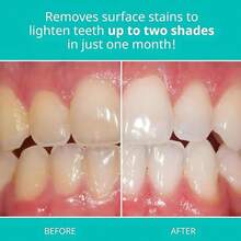 Opalescence Teeth Whitening Toothpaste (Pack Of 2) - Cool Mint Original Formula - Oral Care, Gluten-Free - 4.7 Ounce Made By Ultradent.- TP-5166-2 - 薄荷色 - 查看 3