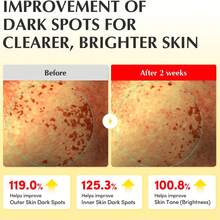 EQQUALBERRY 维他命亮肤爽肤水 - 3% 维他命 C 和烟酰胺 | 温和日常去角质 | 补水保湿，打造水润肌肤 (5.07 液盎司/150 毫升) - 爽膚水 - 查看 8