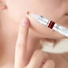 1pc Liquid Skin Pen, Portable Easy, Gentle Hand, Foot, Face,Neck Skin Cleaning Pen, Fast Results Skin Care Stuff, Essential Family And Friends To Use,Conveniently Portable - Hyaluronic Acid - Xem 4