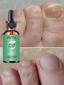 Nail Moisturizing Care Essence, Mild And Non Irritating, Alcohol Free, For Men And Women. - 彩色 - 查看 2