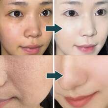 1 mặt nạ đất sét dưỡng ẩm làm sáng da chứa Niacinamide, chăm sóc da mặt, làm sạch lỗ chân lông, se khít lỗ chân lông, làm sáng da, cải thiện tình trạng khô ráp, xỉn màu, cấp ẩm, tăng độ đàn hồi, giúp da mềm mại, mịn màng và không nhờn rít. - trắng - Xem 3