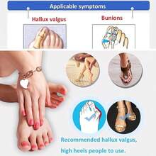 Dispositivo de corrección de hallux valgus, corrector de dedo gordo del pie, espaciador, soporte cómodo y transpirable día y noche, expansor de valgo, alivio del dolor, antideslizante, férula ortopédica para hallux valgus. - Blanco - Ver 7