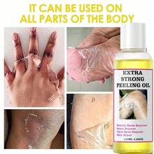 Peeling Oil For Dark Skin, Yellow Peeling Oil, Extra Strong Peeling Oil, Exfoliating Peeling Solution For Body All Skin Type - Màu vàng - Xem 4