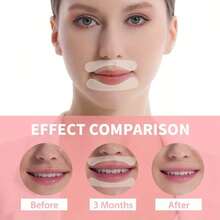 40/20/10pcs Transparent Face Lifting & Lip Plumping Patches, Strong Adhesive & For Skin - Multicolor - View 4