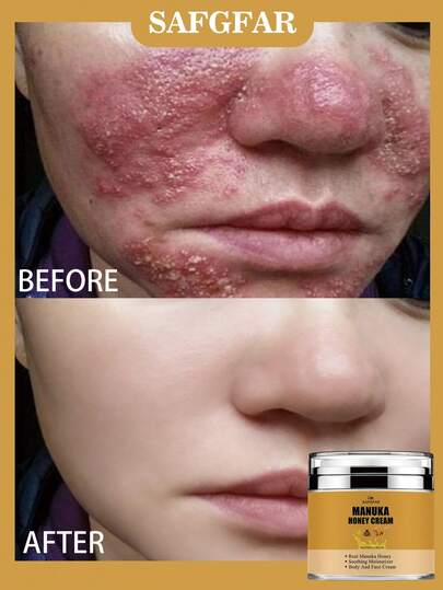 Honey Cream, A Soothing And Moisturizing Cream/Body Butter That Can Be Used For Body And Facial Care, Providing All-Over Hydration.