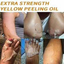 Peeling Oil For Dark Skin, Yellow Peeling Oil, Extra Strong Peeling Oil, Exfoliating Peeling Solution For Body All Skin Type - Màu vàng - Xem 7