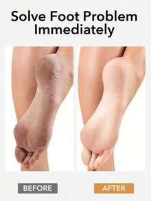 1件装专业足部护理工具，去除老茧和死皮，木质磨脚器，男女通用，去除脚后跟干裂和死皮，专业修脚工具，足部护理，去角质按摩 - A - 查看 5