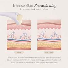 The Ice Roller By Project E Beauty Cryotherapy Treatment Facial Massage Reduce Under Eye Puffiness Dark Circles Muscle Soreness Pain Relief Redness - As Pic - View 5