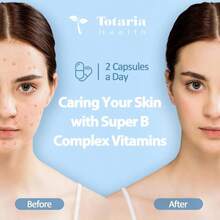 Totarias 13-In-1 Vitamin B Complex Plus With Vitamin B1, B2, B3 (Niacinamide), B4, B5, B6, B7 (Biotin), B8 (Inositol), B9 (Folate), B12, C, D3, K2 - Energy, Nerve, Immune, Skin Support - 120 Vegan Capsules Healthcare Supplement, Free Shipping, Daily Supplement, For Women - 120抽 - 查看 3