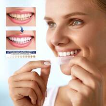 Berlix Teeth Whitening Strips Enamel  For Teeth Whitener, Whitening Strips With Coconut Oil, Formulated To Be Gentle & Non Slip And Quick-Dry, Stains Removal DMPL - As Shown In the Figure - View 4