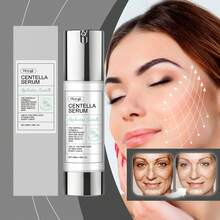 Hoygi 50ml Sérum de Centella Asiática - Reafirmante, reduce las líneas finas, atenúa las manchas, ilumina y uniforma el tono de la piel, calmante, nutritivo, reparador, fortalece la barrera cutánea, mejora la resistencia, esencia para el cuidado de la piel - Suero - Ver 5