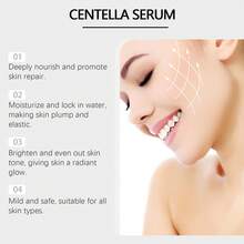 Hoygi 50ml Sérum de Centella Asiática - Reafirmante, reduce las líneas finas, atenúa las manchas, ilumina y uniforma el tono de la piel, calmante, nutritivo, reparador, fortalece la barrera cutánea, mejora la resistencia, esencia para el cuidado de la piel - Suero - Ver 8