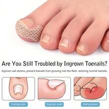 10PCS Toe Patch, Toe Anti-Wear Patch - Multicolor - View 4