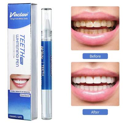  1支Vaclav牙齿美白笔，牙齿美白凝胶，牙齿漂白凝胶，牙齿美白剂，去除牙渍，口腔卫生