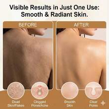 APRICITY Blissal Exfoliating Shower Towel, 2-In-1 Dual-Sided Body Scrubber & Microfiber Scrub Cloth Set, Advanced Exfoliation All Skin Types - 1 - View 2