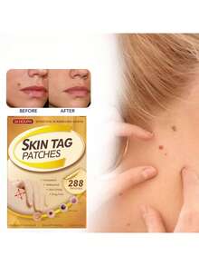 288片透明舒适透气创可贴，粘性强 - 彩色 - 查看 4