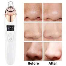 Pore Cleanser & Acne Blackhead Remover: Deep Clean For Clear Skin,Deep Pore Cleanser: Acne & Blackhead Removal In One Use - White - View 2
