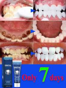 Professional Teeth Whitening Toothpaste With Tartar Control Formula Removes Stubborn Plaque And Yellow Stains For Whiter Teeth A - 1 cái - Xem 1