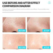 WELLAGE 100% 玻尿酸蓝色安瓶精华，韩国精华液，无香型玻尿酸安瓶，蕴含泛醇、野生山药、积雪草，专为敏感干性肌肤保湿。 - Hyaluronic Acid - 查看 7