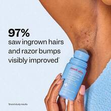 Smooth Repair Ingrown Hair Serum, Razor Bump Treatment, Suitable For Women And Men, Soothes And Calms Sensitive Skin On The Face, Underarms, And Bikini Area | Contains Salicylic Acid And Glycolic Acid | Vegan And Cruelty-Free - Kem - Xem 2