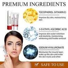 2-Piece Set Whitening And Spot-Removing Cream, Facial Pigment Lightening Cream, Moisturizing Cream For Removing Facial Melasma, Dark Spots, Wrinkles, And Blemishes - 多色的 - 查看 5