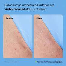 Smooth Repair Ingrown Hair Serum, Razor Bump Treatment, Suitable For Women And Men, Soothes And Calms Sensitive Skin On The Face, Underarms, And Bikini Area | Contains Salicylic Acid And Glycolic Acid | Vegan And Cruelty-Free - Kem - Xem 6