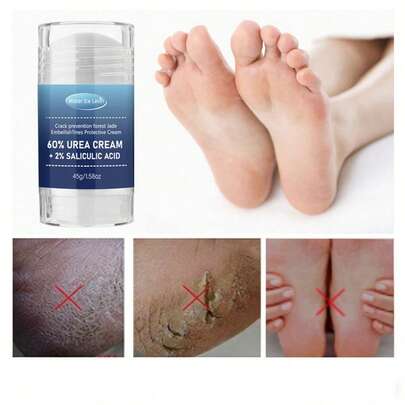 Crema de pies con 60% de urea y 2% de ácido salicílico - Tratamiento para talones agrietados | Exfoliante de pies, terapia de hidratación profunda y nutrición para pies extremadamente agrietados, crema de manos, loción hidratante, hidratante, anti-agrietamiento, suavizante y crema nutritiva
