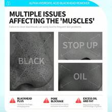 WELLAGE 100% 玻尿酸蓝色安瓶精华，韩国精华液，无香型玻尿酸安瓶，蕴含泛醇、野生山药、积雪草，专为敏感干性肌肤保湿。 - Hyaluronic Acid - 查看 6