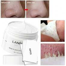 黑头去除面膜 - 鼻部及面部撕拉式面膜，黑头去除套装 1.05盎司 - 泥膜 - 查看 5