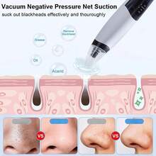 150mAh Rechargeable Electric Blackhead Vacuum Cleaner, Portable Facial Pore Cleansing Suction Device - Multicolor - View 7