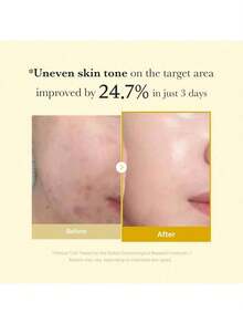 2-Pack Kojic Acid & Turmeric Overnight Peel Off Facial Peel, Vitamin C Brightening Facial Treatment, 2.53 Fl.Oz Korean Skin Care For Clear Glowing Complexion | Perfect Daily Essential & Women's Gift For Holidays - 彩色 - 查看 2