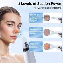 150mAh Rechargeable Electric Blackhead Vacuum Cleaner, Portable Facial Pore Cleansing Suction Device - Multicolor - View 6