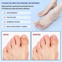 TendenciaLc Parches Para Uñas Fúngicos 21pcs/caja De Parches ParaCalidad premium - 1 - Ver 3