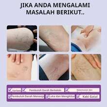 Say Goodbye To Earthworm Legs And Become Healthy Legs - 1 Item - View 5