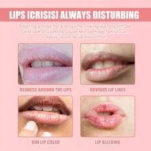 7.5g,Strawberry Lip Balm, Deeply Moisturizing, Quickly Exfoliating, Improving Dull Lip Color, Enhancing Complexion, Soft, Delicate, Light And Non-Greasy, Reducing Lip Wrinkles - Strawberry - Xem 3