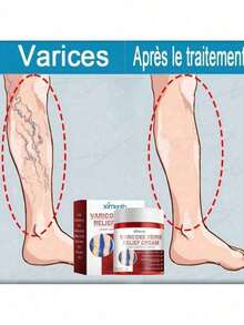 Leg Massage Relieves Leg Swelling Care Tool - Beige - View 1