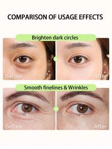 视黄醇精华液 - 视黄醇紧致护理，温和滋养并提亮肌肤；视黄醇眼霜 - 改善肌肤光泽 | 韩国护肤 - 10毫升面部精华液 - Retinol - 查看 3