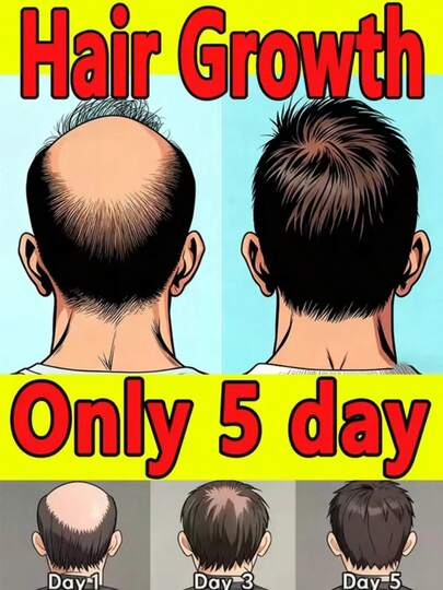 Generation-2,Nourish Hair Roots To Create Healthy Hair And Silky, Voluminous Hair.
