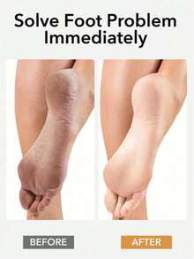 1 Pc Professional Foot File With Natural Bamboo Handle, Deep Exfoliating Callus Remover, Home SPA Care, Say Goodbye To Rough Feet - 1PC - View 3