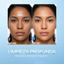 100G Gel Limpiador Facial con Ácido Hialurónico y Niacinamida | Limpieza Suave, Hidratación Profunda y Piel Radiante | Para Todo Tipo de Piel, Incluida Piel Sensible - 100 gramos - Ver 4